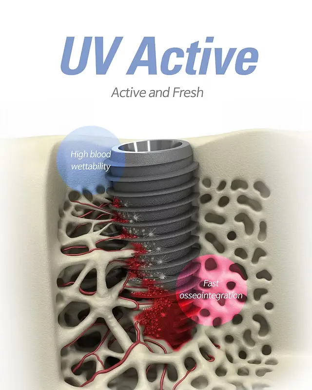 UV Tekniği ile Dikişsiz İmplant Yapan Klinikler Ankara